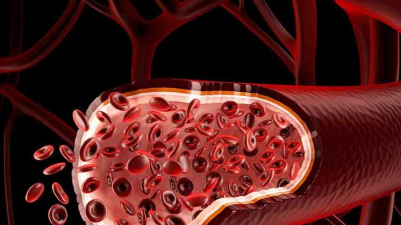 Kandan sinsi sinsi ilerliyor. Günün birinde hayatı kabusa çeviriyor. Bu hastalığa dikkat