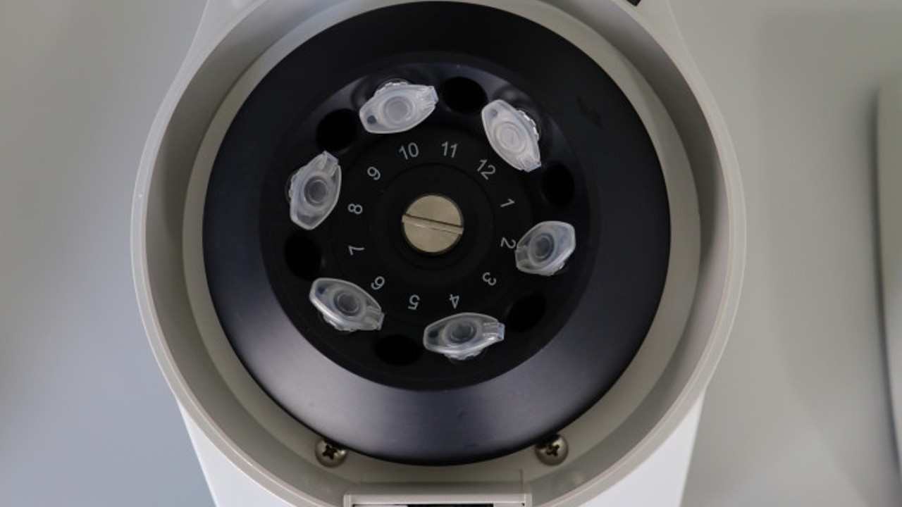 TÜBİTAK destek verdi : Türk Bilim İnsanları geliştirdi Kovid-19'u 10 dakikada teşhis edecek