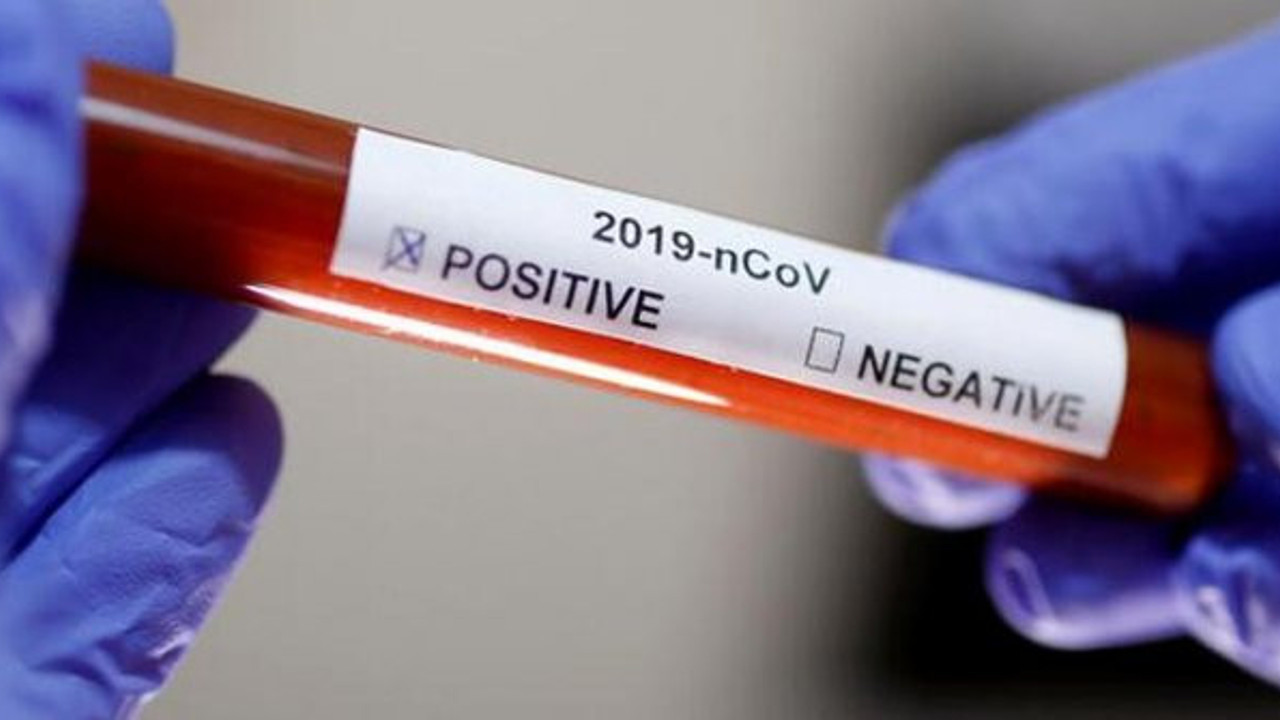 İlçe Başkanı da korona virüse yakalandı