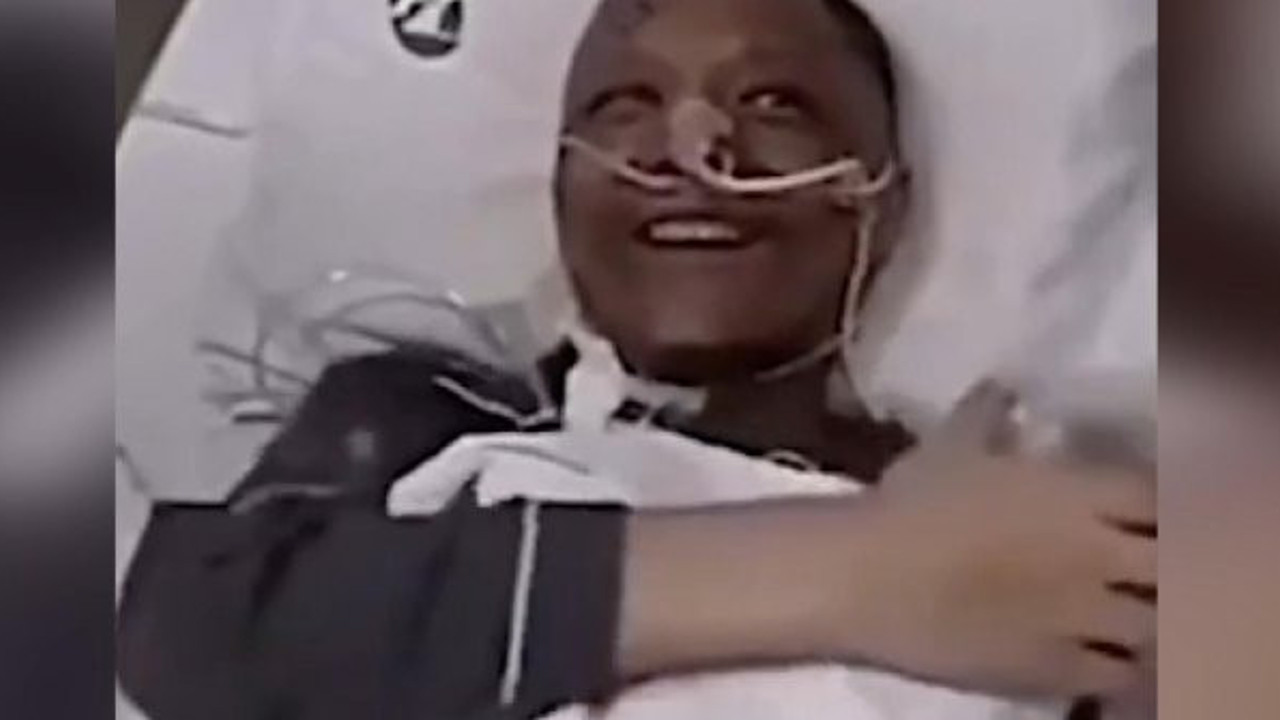 Yedi ayda ten rengi üç sefer değişti. Mucize doktorun son hali şaşkına çevirdi