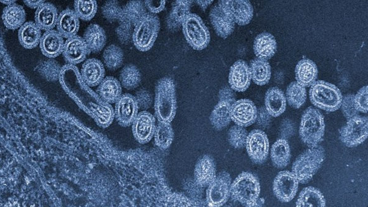 Bilim insanları yeni felaketi böyle duyurdu. Korona bunun yanında hafif kalacak. Tehlikeyi marketlerden eve getiriyoruz