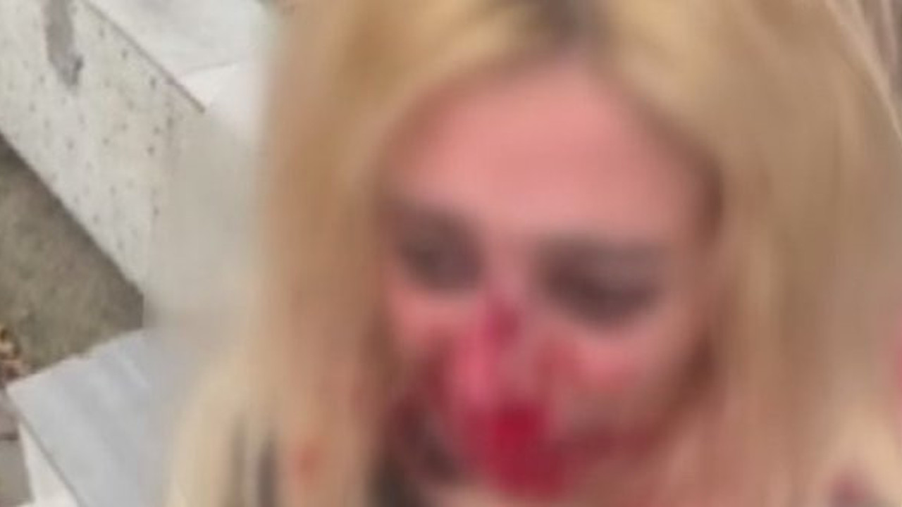 Ellerin kırılsın bir kadına el kalkar mı. Kadını bu hale soktu