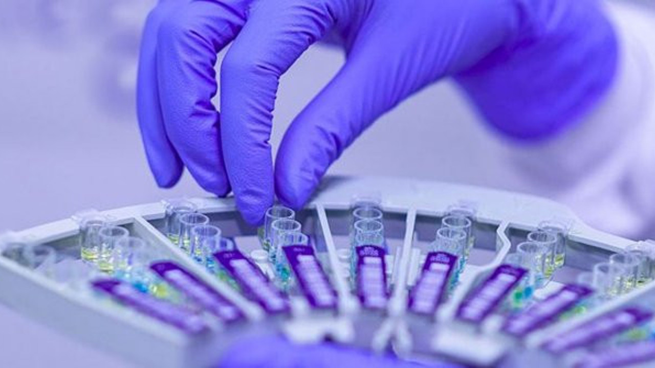 Kimsenin söyleyemediğini açıkladı. Prof. Dr. Ece'den şok eden test kiti uyarısı