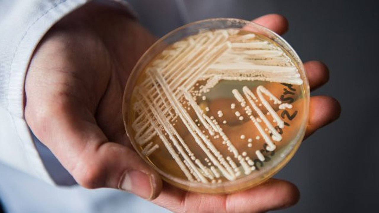 Bilim insanları tedavisi yok ve ölümcül diyerek açıkladı. Yayılmaması için acil çalışma başlatıldı