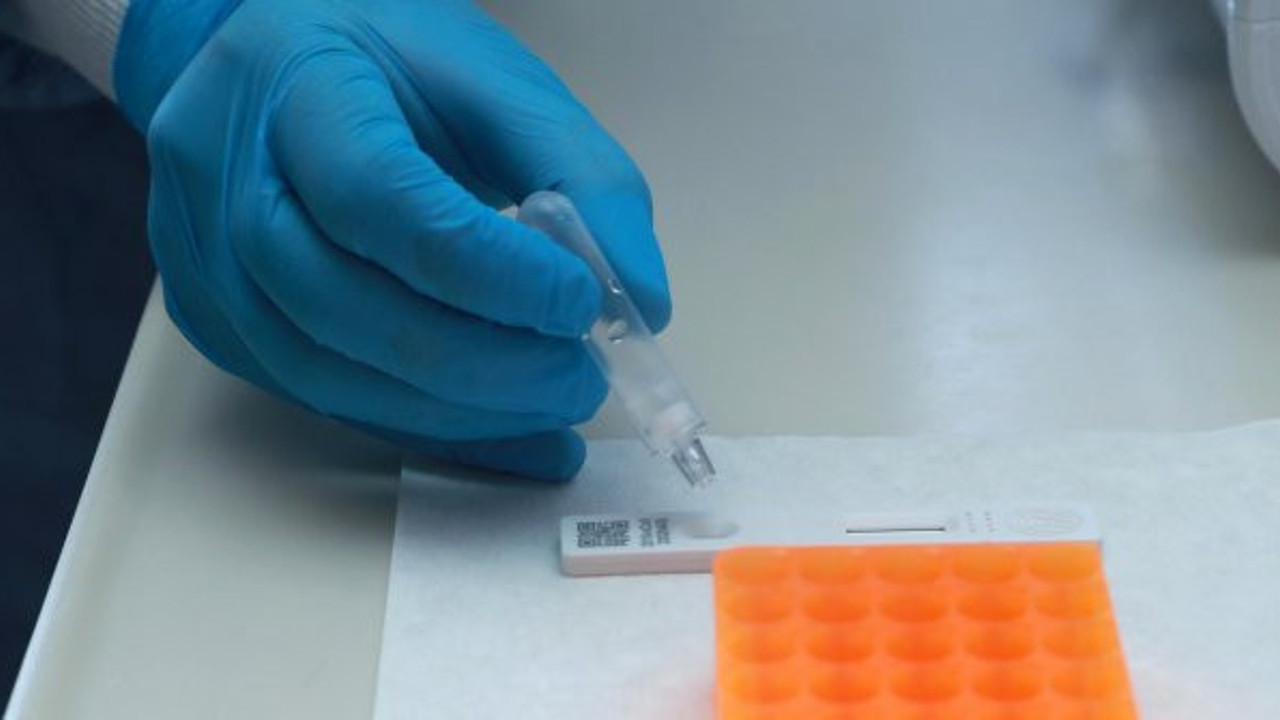Sağlık Bakanlığı'ndan korona virüs test kiti satışı yapan sitelere erişim engeli