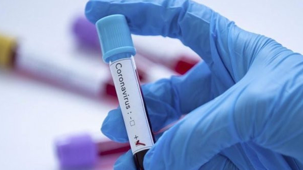 Türk bilim insanları başardı. Korona virüs 10 saniyede tespit edilecek