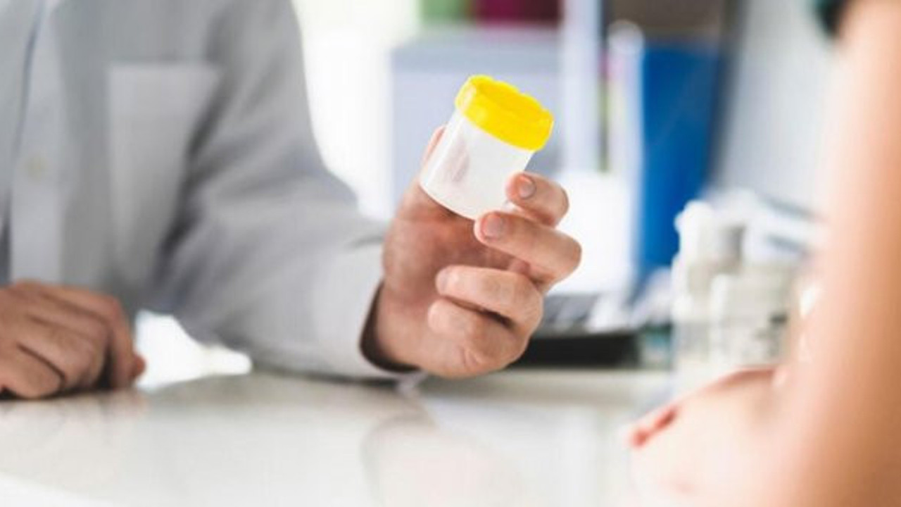 Korona virüsü idrardan tespit edecekler