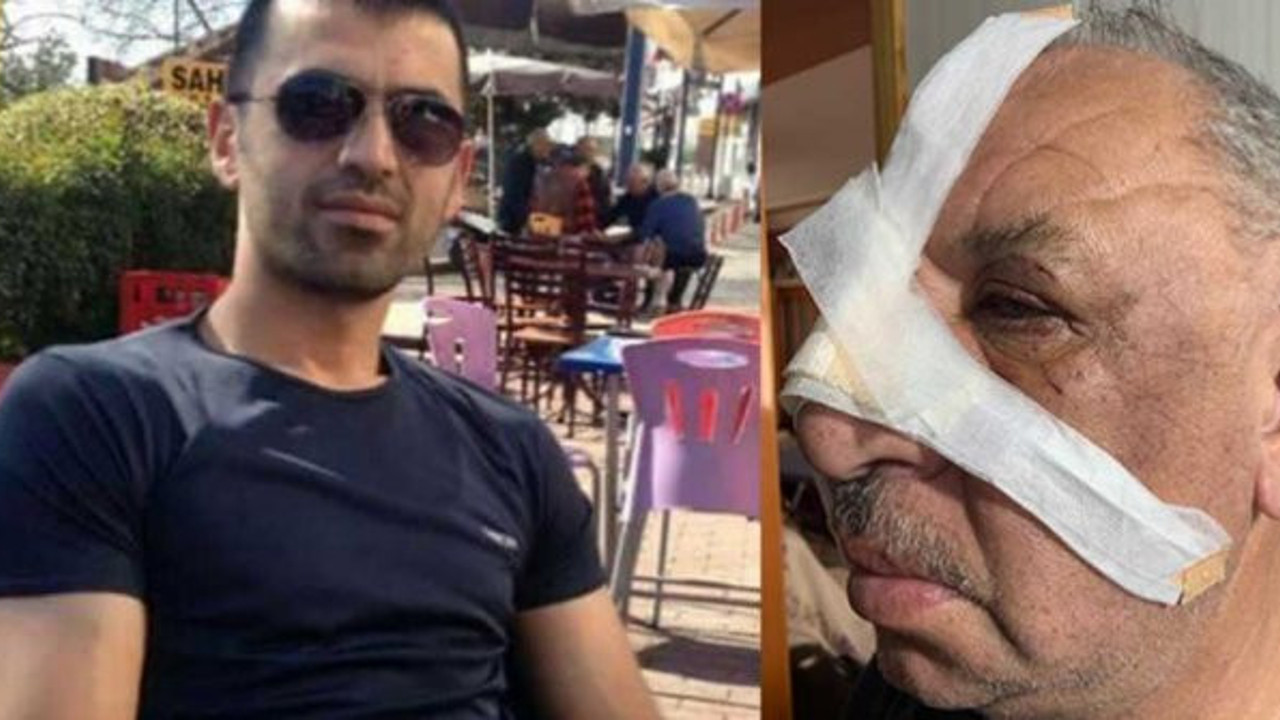 Aracına çarptığı şehit babasını burnunu kırarak hastanelik etti. Kıyak atamayla gündeme gelmişti!