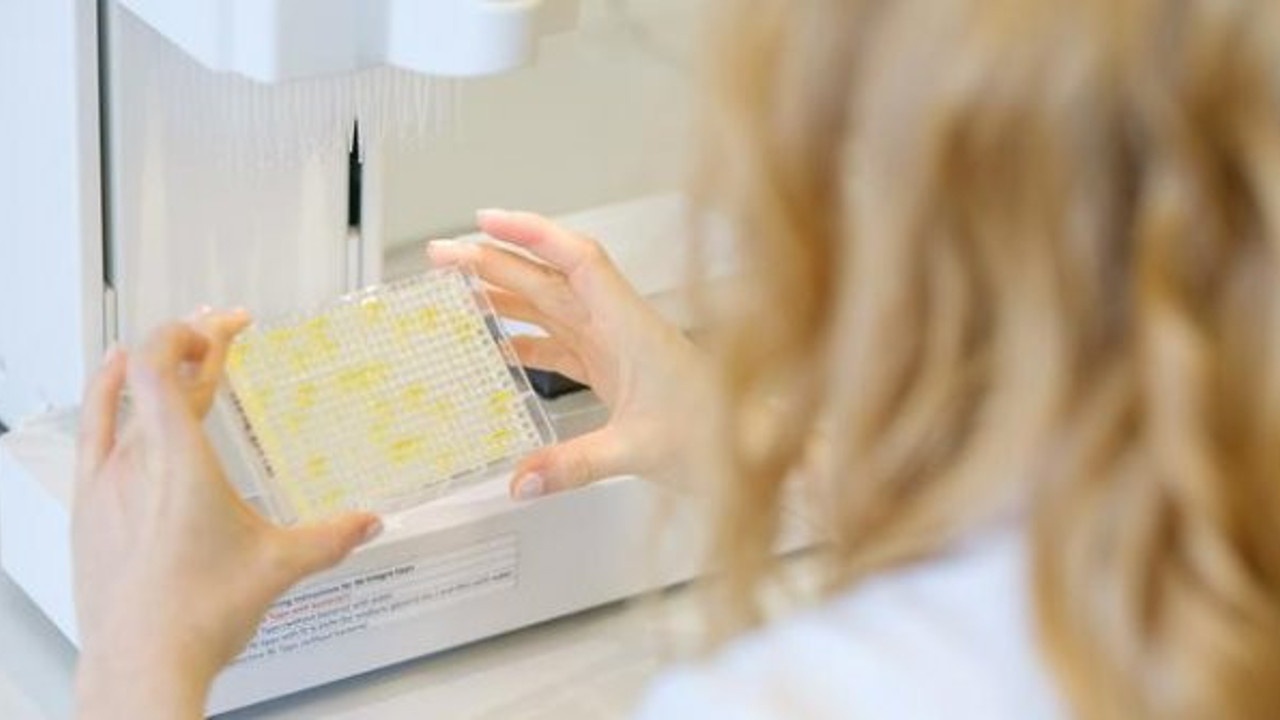 Hayat kurtaracak iki ilaç yüzde vererek açıklandı. Korona virüsde umut vaad eden yeni bir gelişme daha gerçekleşti