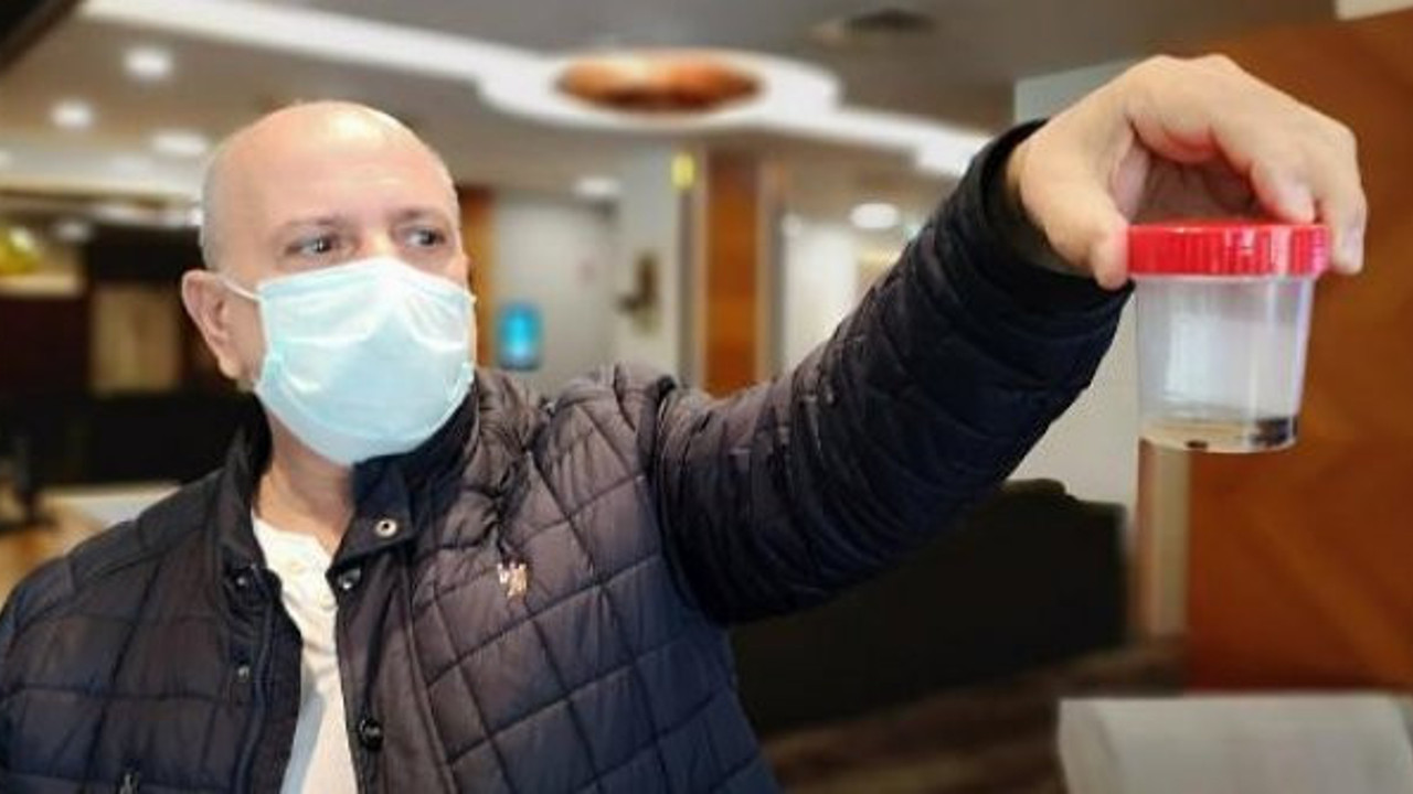 İstanbul'da yaşayan Yusuf Çebi'nin Akciğerinden 32 yıl sonra çam fıstığı çıktı