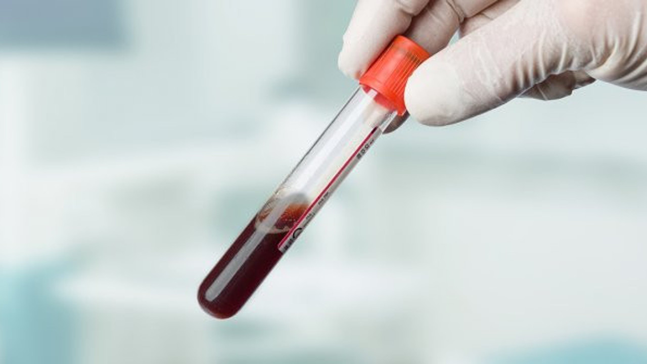 Bilim insanları son hazırlıkları tamamlamak üzere. Artık kan tahlili ile tespit edilecek