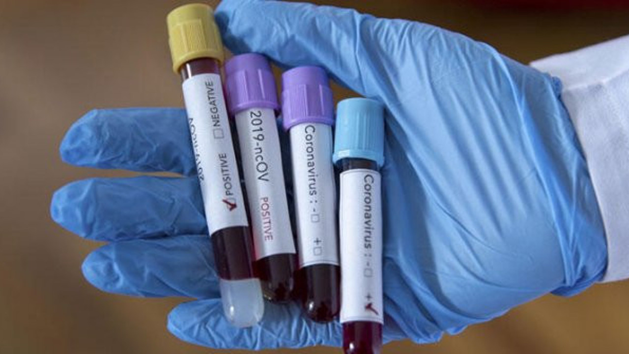 Çin'de sahte korona aşısı skandalı. Yurt dışına da pazarladıkları sahte aşıların içine bakın ne koymuşlar