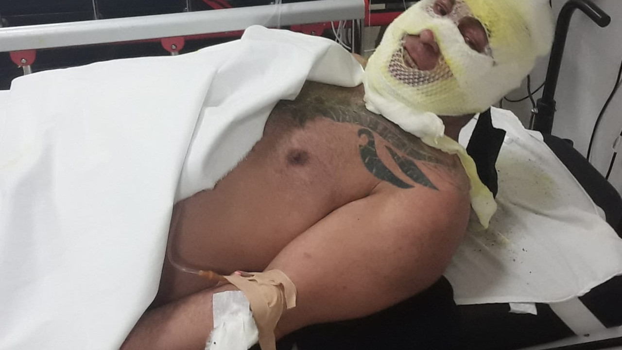 İş görüşmesi için gitti otelde kendini yaktı