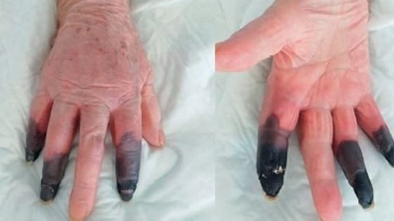 Koronayı atlattım diye sevinme. Başımıza bir de bu geldi