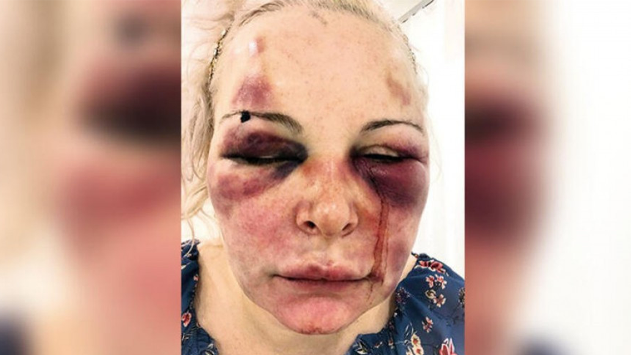 Otel odasında işkence. Anlattıkları kan dondurdu