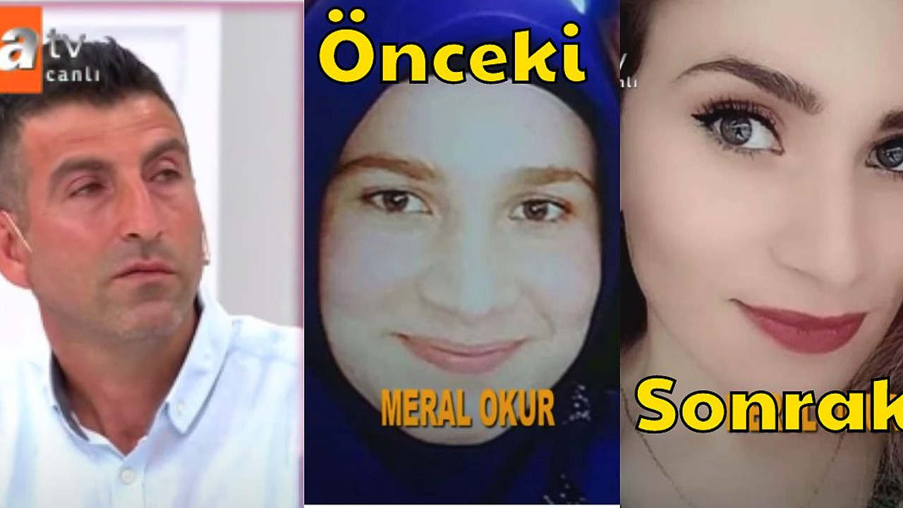 Eşi estetik olsun diye hayvanlarını yarı fiyatına sattı. Operasyon sonrası aldığı cevapla şok oldu