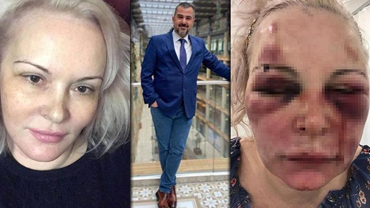 Rus sevgiliye otelde cehennemi yaşattı. Alp Mutlu için istenen ceza belli oldu