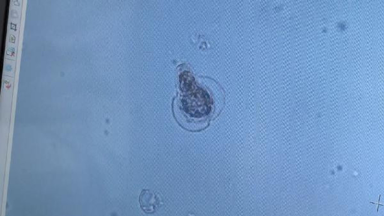 Müsilajda görmediğimiz yeni bir canlı türü bulduk