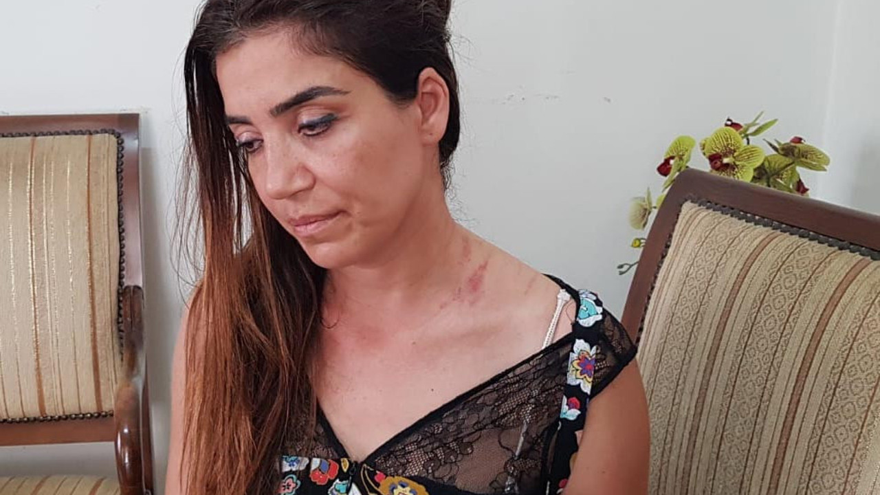 Hatay'daki iki doktorun kavgasında yeni gelişme