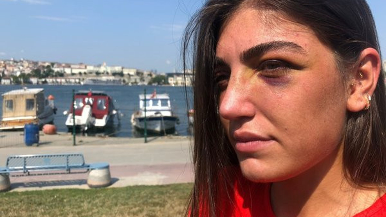 Genç mankene gece kulübünde öldüresiye dayak