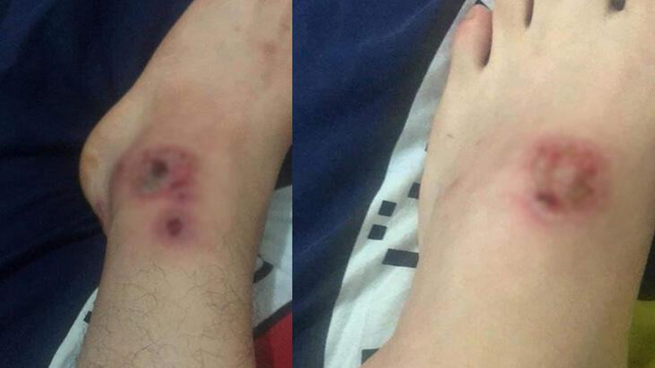 Ölümcül tehlike İstanbul geneline yayıldı