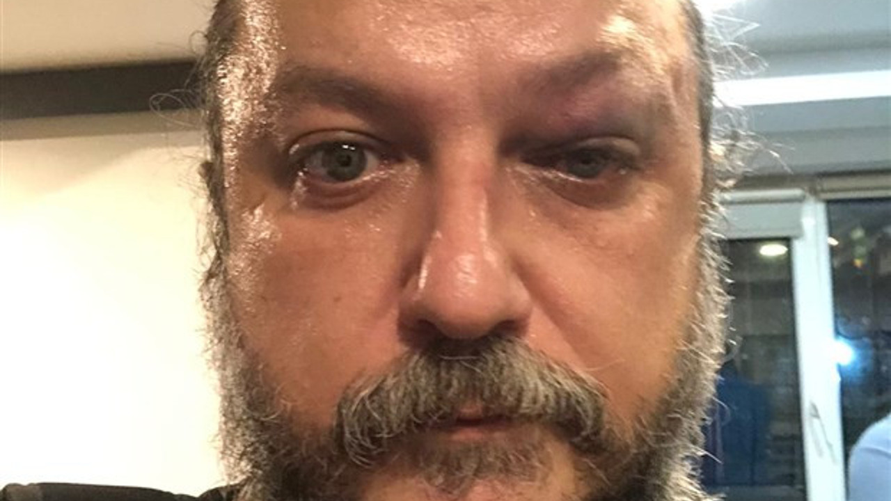 Sanatçı Güvenç Dağüstün’e konser sonrası saldırı