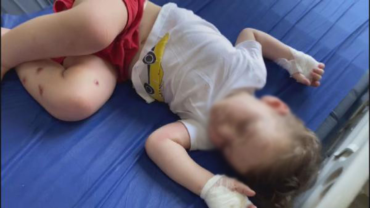 Suriyeli babadan 2 yaşındaki çocuğuna sigaralı işkenceye şoke eden savunma