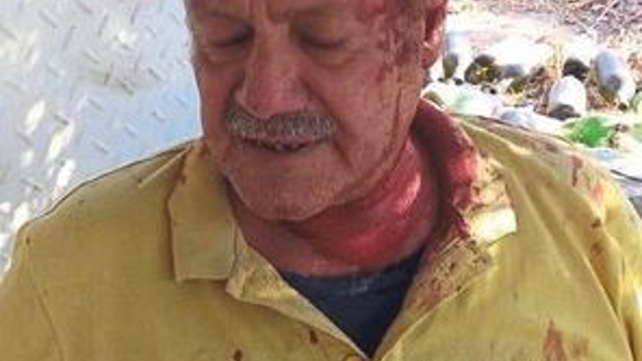 Mermer ocağını şikayet etti, saldırıya uğradı