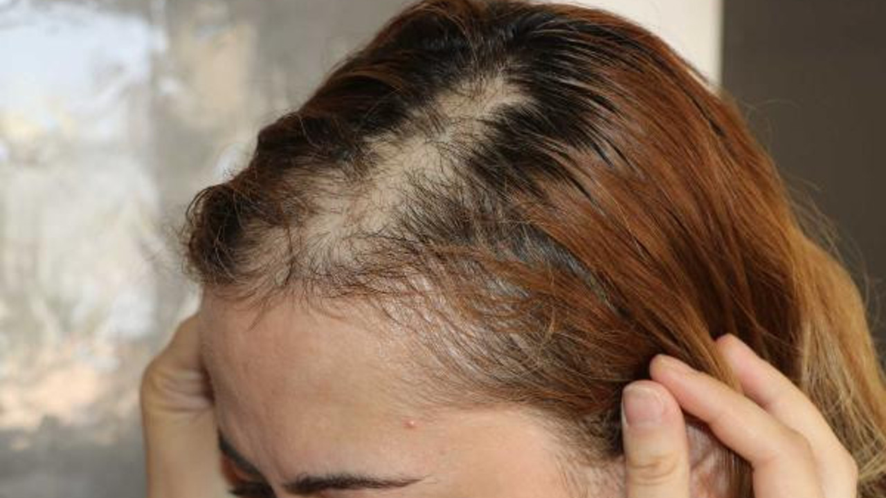 Hasta, hemşirenin saçını yoldu