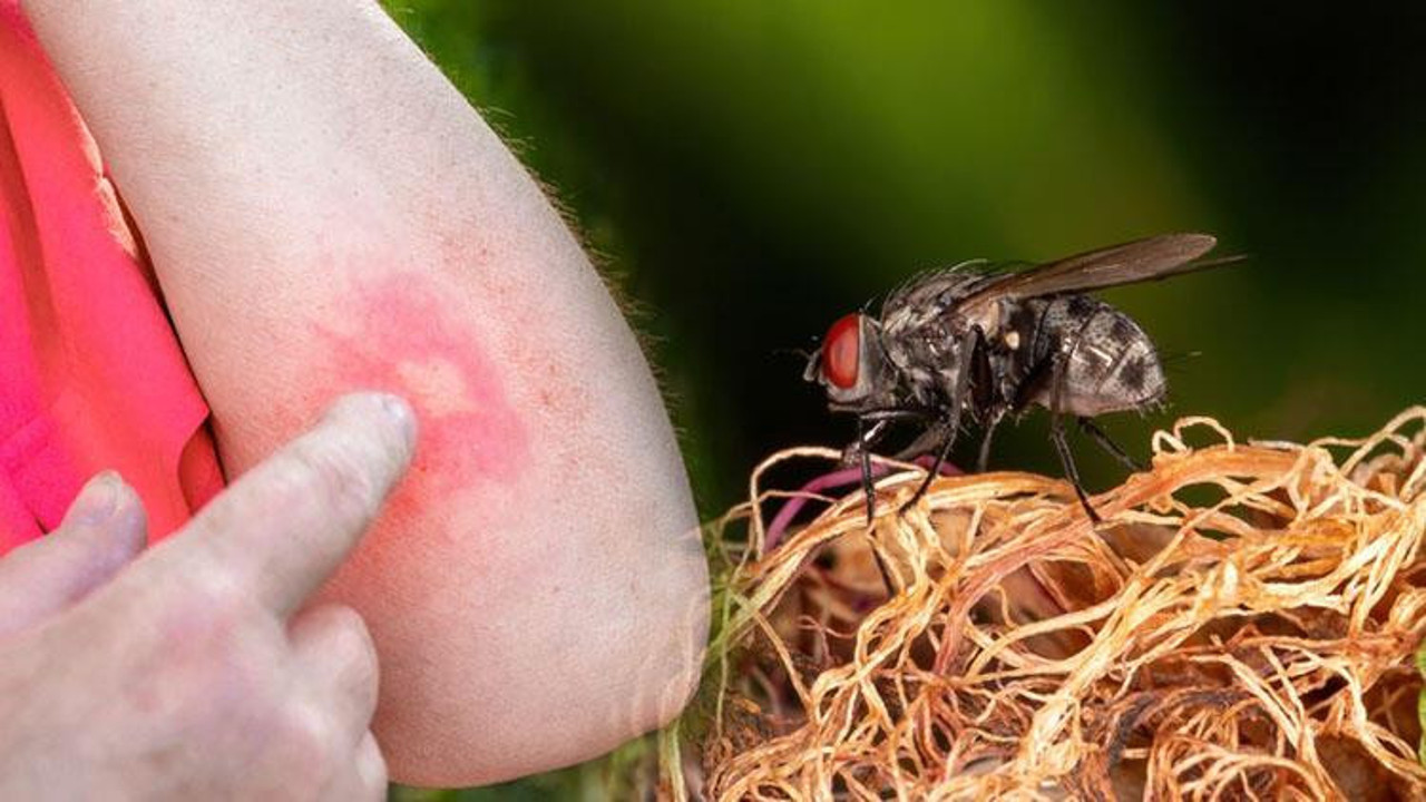 Baldırsokan İstanbul'da
