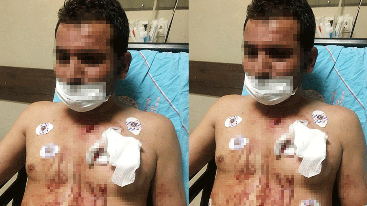 Eve gizlice girip sevgilisini bıçakladı