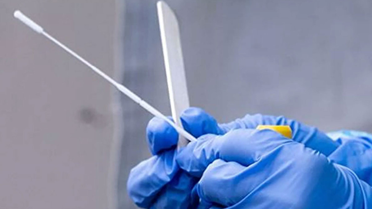 Diş fırçalar gibi korona virüs testi. İmzalar atıldı