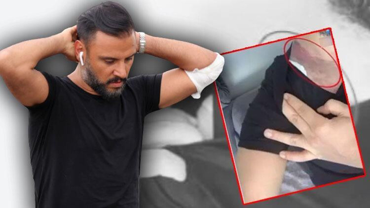 Tişörtle denize giren Alişan 2 milyonluk dava açtı