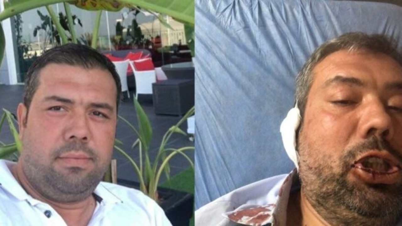 MHP’li belediye aleyhine paylaşım yapan mühendise saldırı, O anlar kamerada