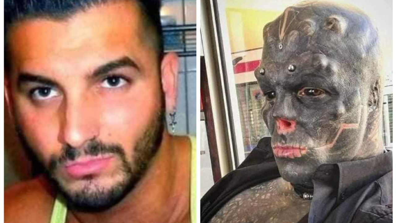 Cerrahlar bile emin misin diye defalarca sordu