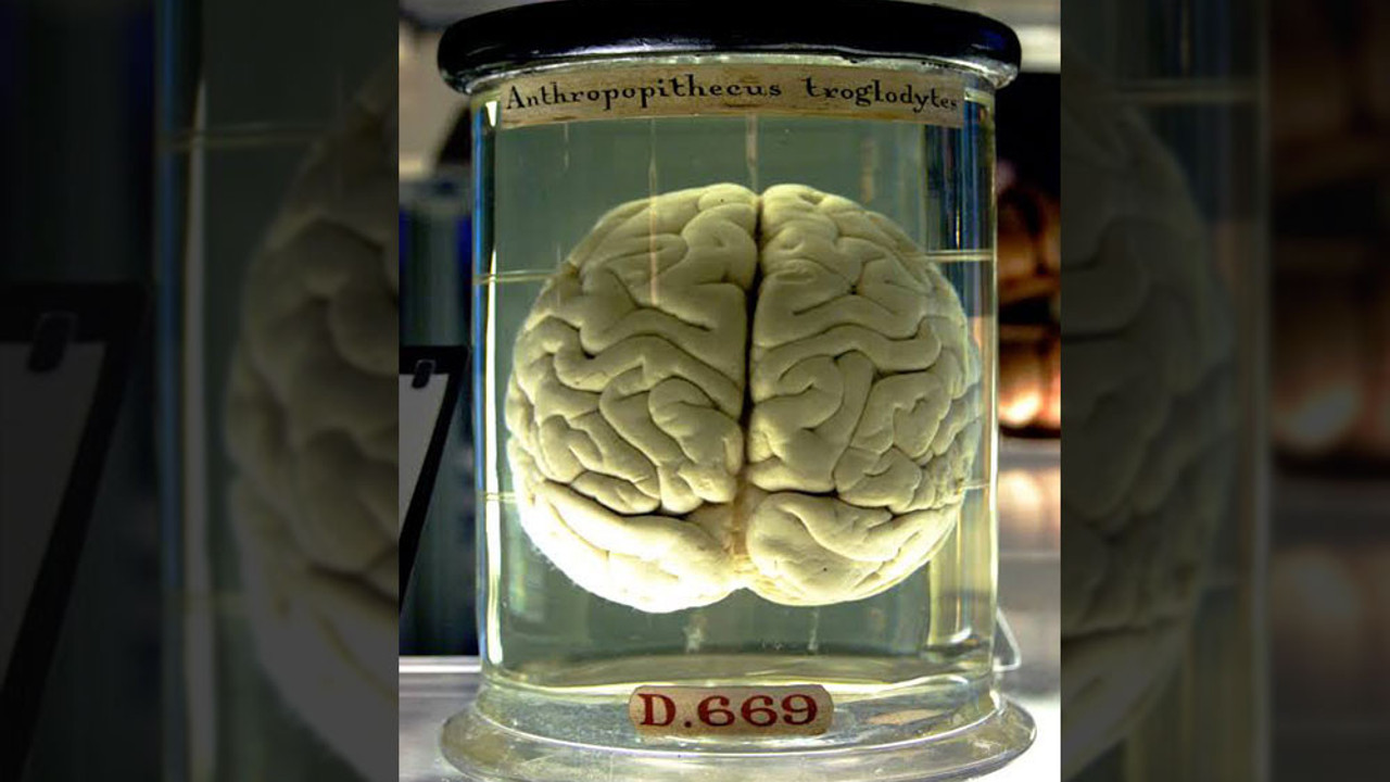 Beyin 1 litre su, 150 gram yağ, 15 gram şeker, 110 gram protein, 10 gram tuzdan ibarettir