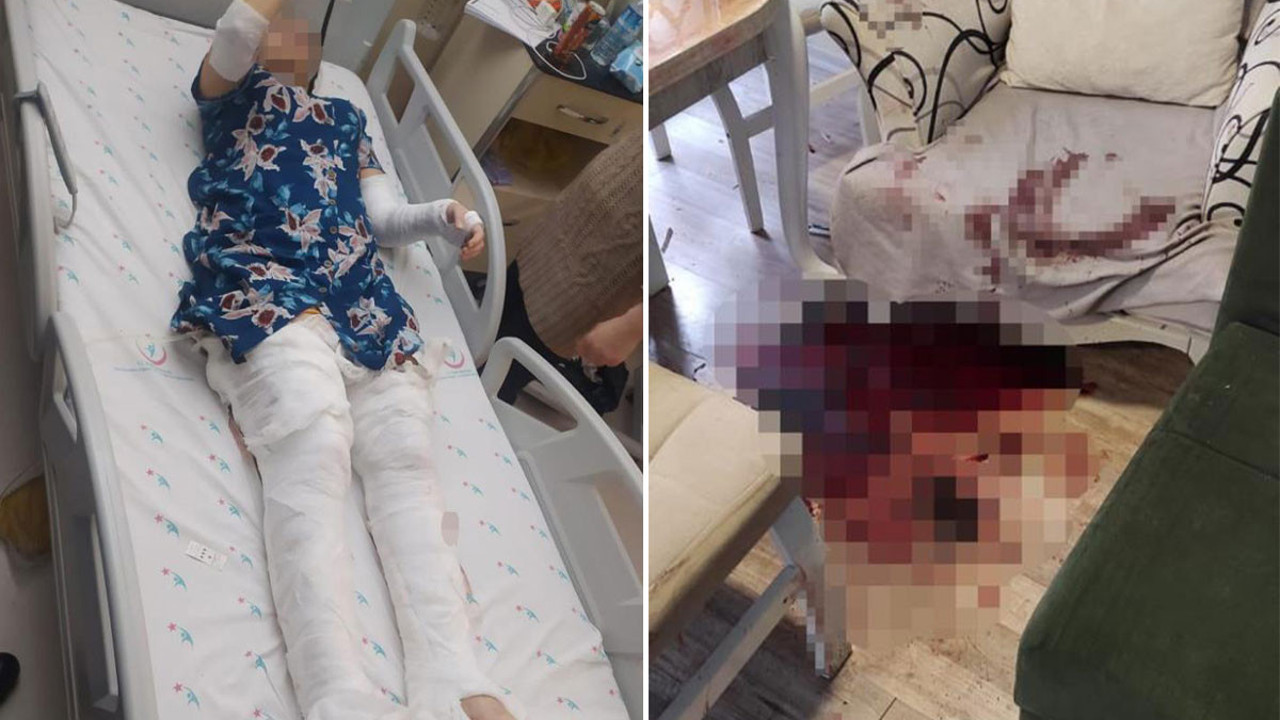 İstanbul’da koca dehşeti: Kucağına çocuğunu alıp eşine 12 el ateş etti