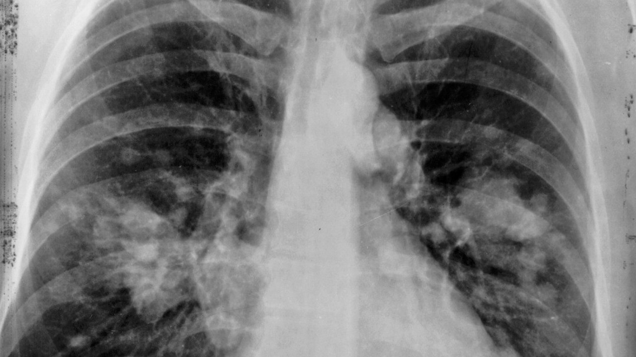 Akciğerlerinizi sıfırlayın