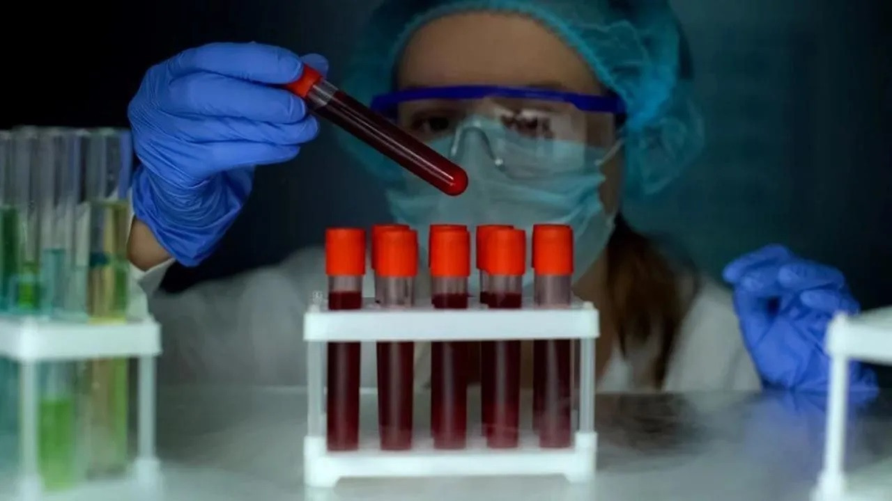 Vücudumuzda bu iki protein varsa kısa yaşıyormuşuz