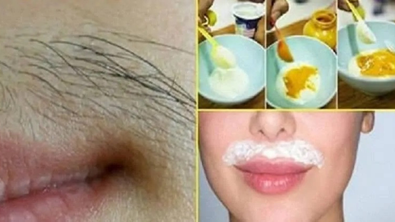 Dudak üstü tüylerden kökten kurtulmak için 2 mucizevi karışım