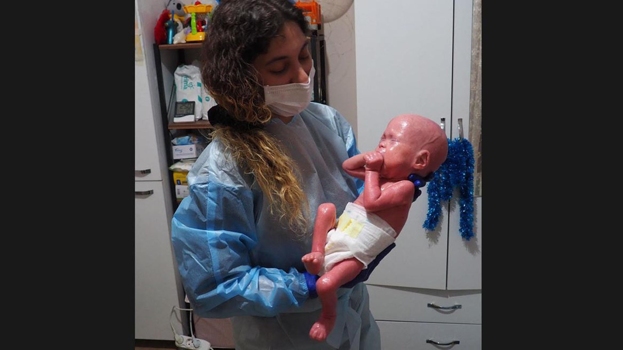 ‘Yılan bebek’ Gökdeniz 1 yaşında. Çıplak elle dokunulması öpülmesi yasak