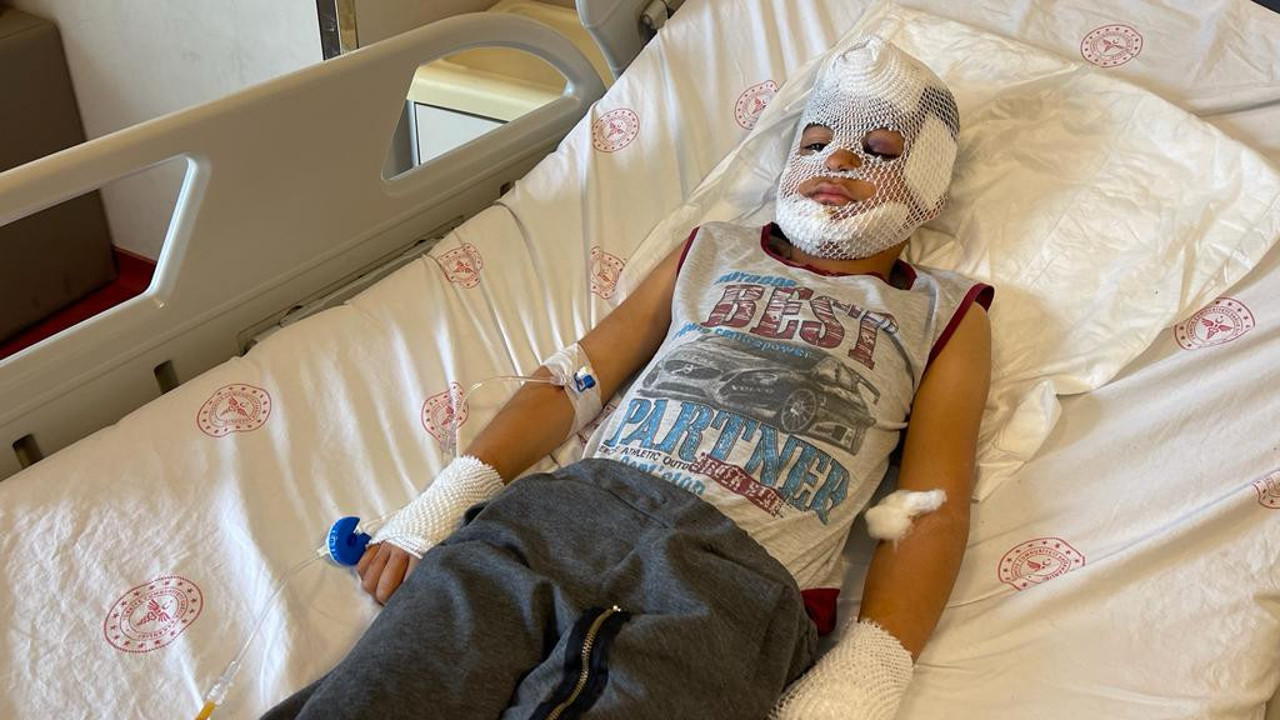 Köpeğin sahibi hakkında flaş gelişme! Ahmet’e oyun oynarken saldırıp ağır yaralamıştı