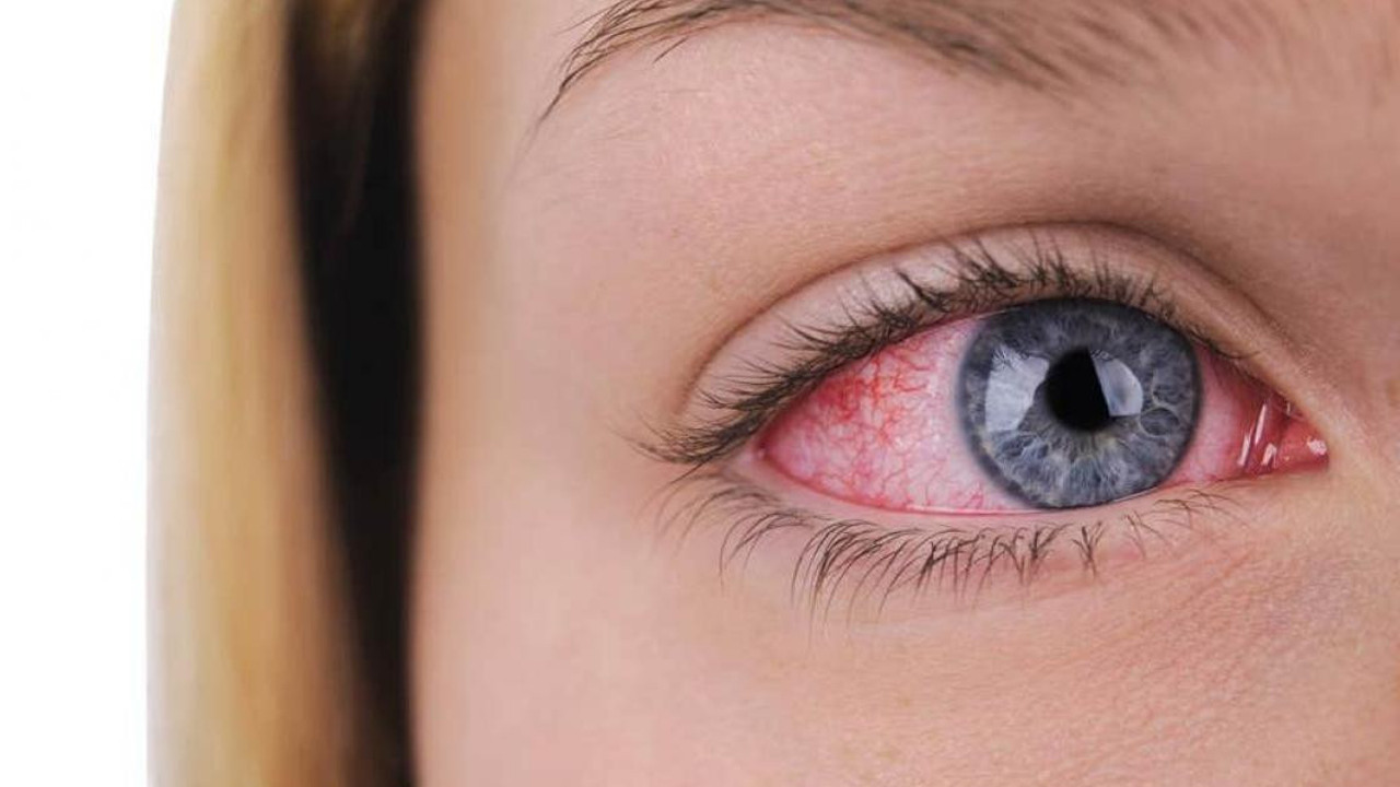 Glokom körlüğe neden olabilir