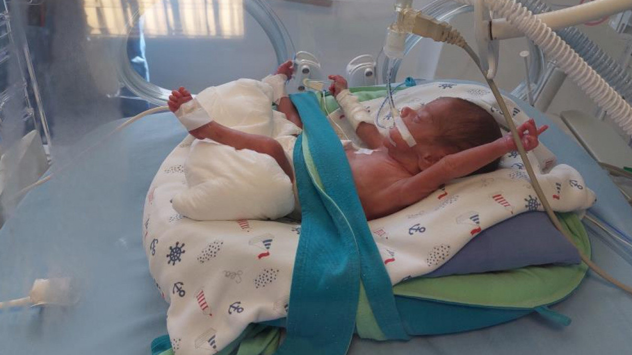 495 gramlık prematüre bebeğe kök hücre nakli yapıldı