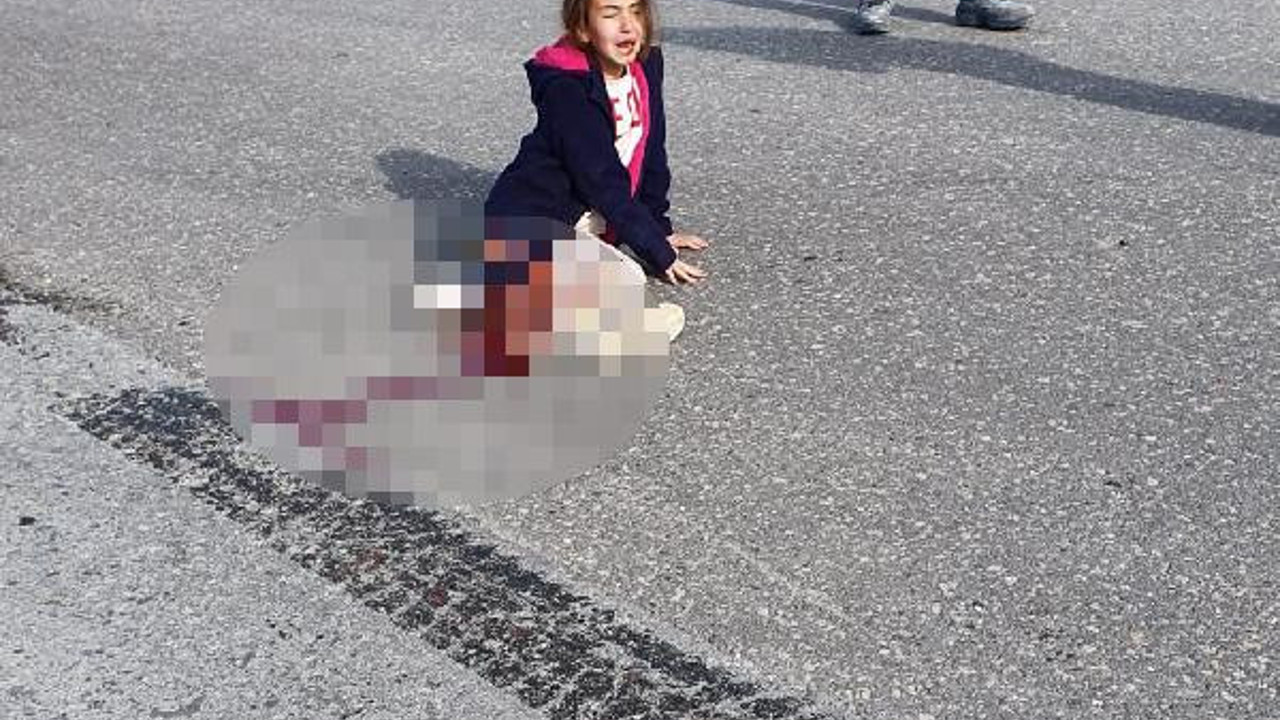 Sokak köpeklerinden kaçarken kamyon altında kaldı, bacağı kesildi. Sokak köpeklerini savunanlar bu kızın bacağını kim geri getirecek