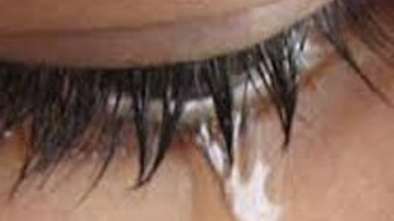 Gözyaşı dök, çabuk iyileş!