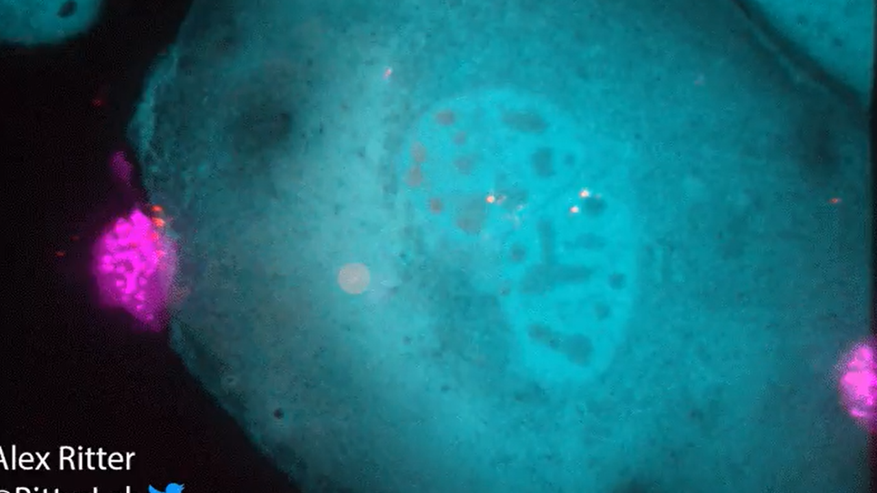 Cüsse her şey değildir. T hücresinin kendisinden kat kat büyük bir kanser hücresini yok ediş anı