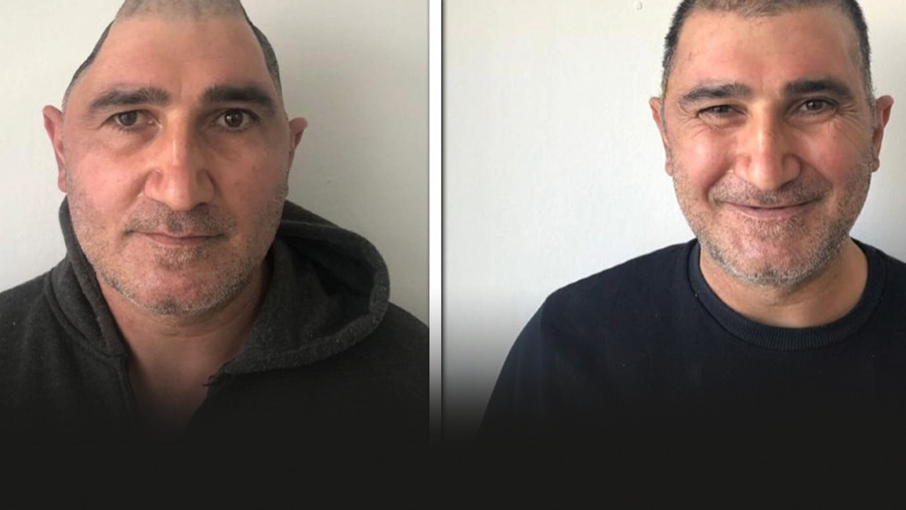 Kafatasının yüzde 83'ü parçalandı: Mucizevi yöntemle eski haline kavuştu!