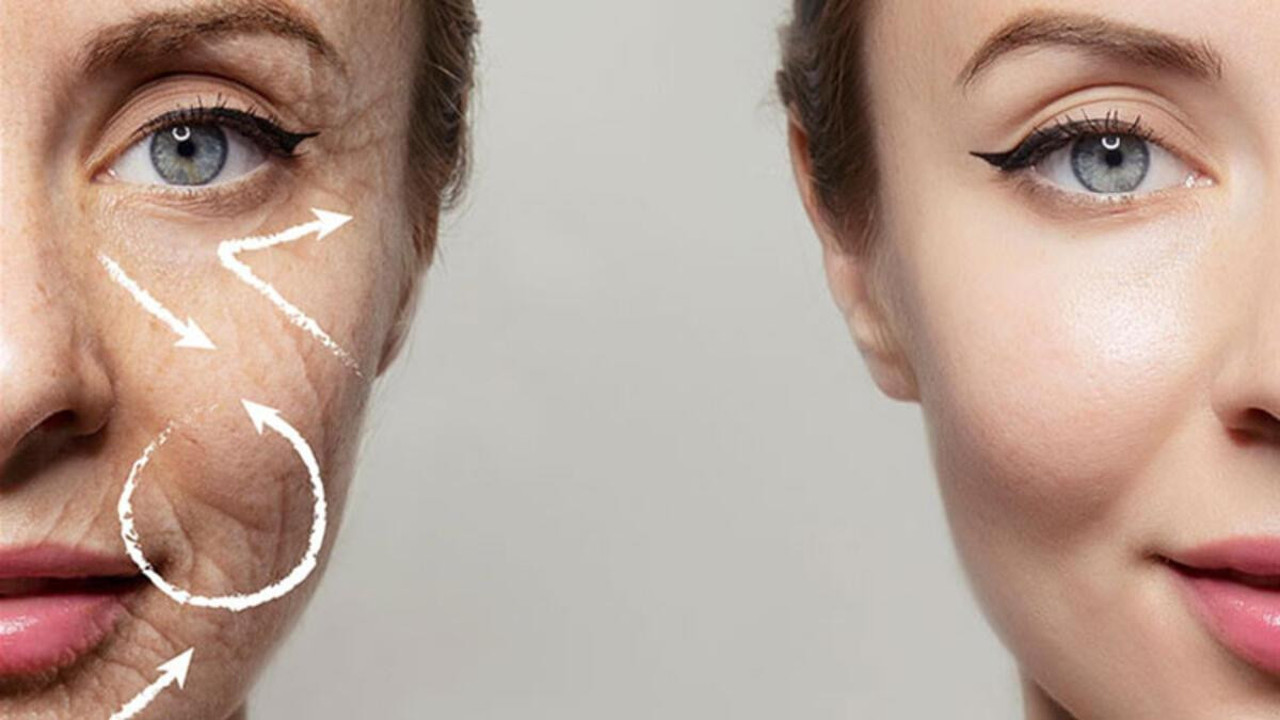 Bedeninizdeki kırışıklıklara karşı Endopeel yöntemi...