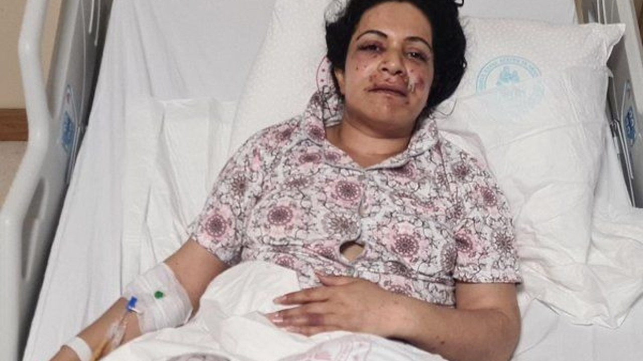 Kıskanç elti gelini ağzından vurdu